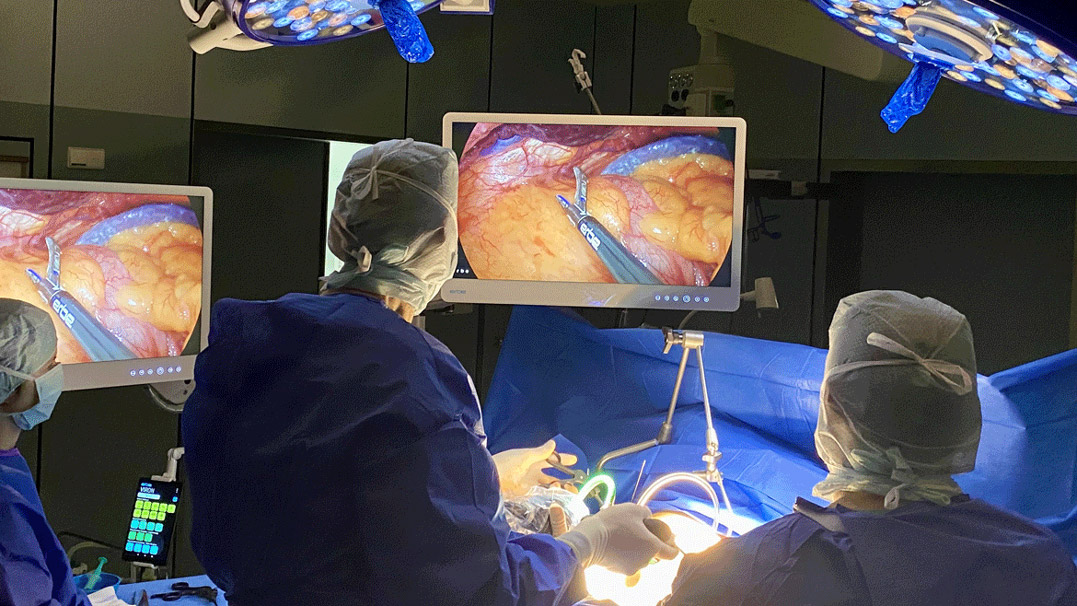 The VIRON X camera system is designed for demanding applications: Impressive image quality in 4K and visualization of fluorescence offer a wide range of possibilities, especially in laparoscopy.